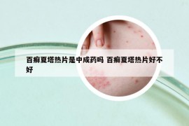 百癣夏塔热片是中成药吗 百癣夏塔热片好不好