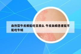 血热型牛皮癣能吃豆腐么 牛皮血癣患者能不能吃牛蛙