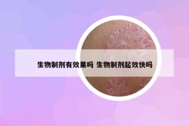 生物制剂有效果吗 生物制剂起效快吗