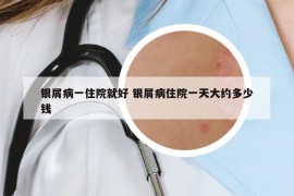 银屑病一住院就好 银屑病住院一天大约多少钱