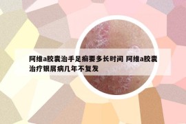 阿维a胶囊治手足癣要多长时间 阿维a胶囊治疗银屑病几年不复发