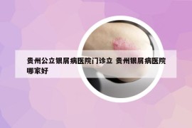 贵州公立银屑病医院门诊立 贵州银屑病医院哪家好