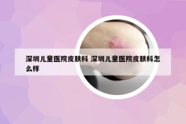 深圳儿童医院皮肤科 深圳儿童医院皮肤科怎么样