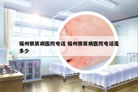 福州银屑病医院电话 福州银屑病医院电话是多少