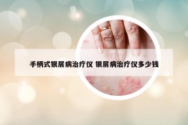 手柄式银屑病治疗仪 银屑病治疗仪多少钱