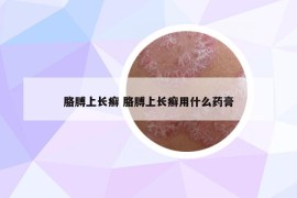 胳膊上长癣 胳膊上长癣用什么药膏