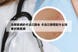 治银销病的卡泊三醇水 卡泊三醇搭配什么效果好银屑病