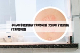 阜新哪家医院能打生物制剂 沈阳哪个医院能打生物制剂