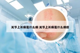 关节上长癣是什么病 关节上长癣是什么病症