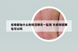 皮痒癣加什么粉和流磺膏一起用 长癣用硫磺皂可以吗