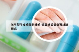 关节型牛皮癣能跳绳吗 银屑病关节炎可以跳绳吗