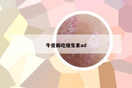 牛皮癣吃维生素ad