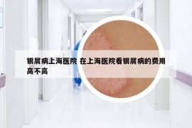 银屑病上海医院 在上海医院看银屑病的费用高不高