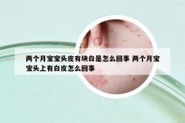 两个月宝宝头皮有块白是怎么回事 两个月宝宝头上有白皮怎么回事