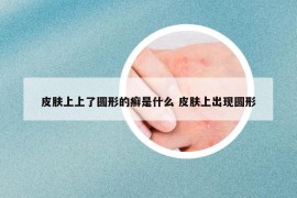 皮肤上上了圆形的癣是什么 皮肤上出现圆形