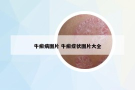 牛癣病图片 牛癣症状图片大全