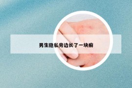 男生隐私旁边长了一块癣