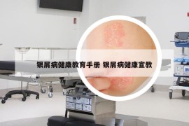 银屑病健康教育手册 银屑病健康宣教