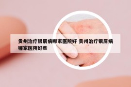 贵州治疗银屑病哪家医院好 贵州治疗银屑病哪家医院好些