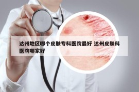 达州地区哪个皮肤专科医院最好 达州皮肤科医院哪家好