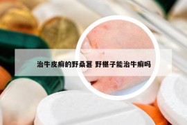 治牛皮癣的野桑葚 野椹子能治牛癣吗