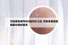 河南银屑病专科9端刘长江优 河南省看银屑病最权威的医生