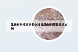 生物制剂报销完多少钱 生物制剂医保报销比例