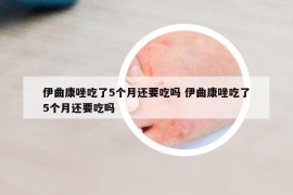 伊曲康唑吃了5个月还要吃吗 伊曲康唑吃了5个月还要吃吗