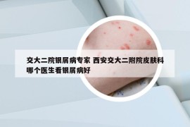 交大二院银屑病专家 西安交大二附院皮肤科哪个医生看银屑病好