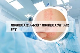 银屑病夏天怎么不爱好 银屑病夏天为什么就好了