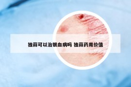 独蒜可以治银血病吗 独蒜药用价值