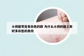 小孩腿弯处有白色的藓 为什么小孩的腿上有好多白色的条纹