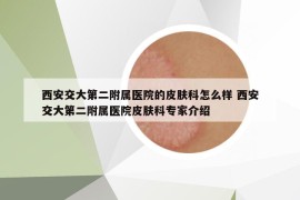 西安交大第二附属医院的皮肤科怎么样 西安交大第二附属医院皮肤科专家介绍