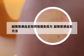 副银屑病自愈如何增强免疫力 副银屑病自愈方法