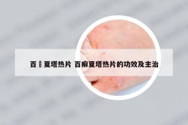 百廯夏塔热片 百癣夏塔热片的功效及主治