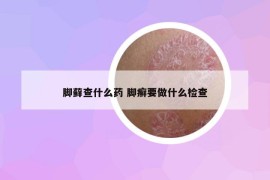 脚藓查什么药 脚癣要做什么检查