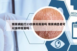 银屑病能打23价肺炎疫苗吗 银屑病患者可以接种疫苗吗