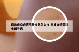 商丘市交通医院看皮肤怎么样 商丘交通医院电话号码