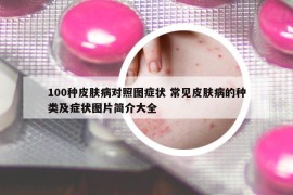 100种皮肤病对照图症状 常见皮肤病的种类及症状图片简介大全