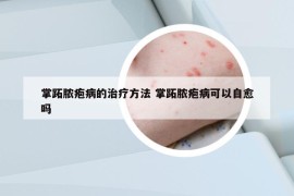 掌跖脓疱病的治疗方法 掌跖脓疱病可以自愈吗