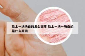 脸上一块块白的怎么回事 脸上一块一块白的是什么原因