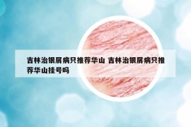 吉林治银屑病只推荐华山 吉林治银屑病只推荐华山挂号吗