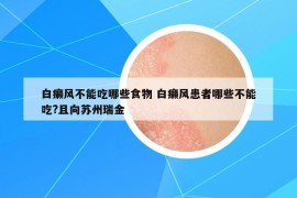 白癞风不能吃哪些食物 白癞风患者哪些不能吃?且向苏州瑞金