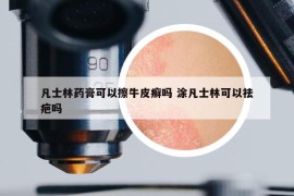 凡士林药膏可以擦牛皮癣吗 涂凡士林可以祛疤吗