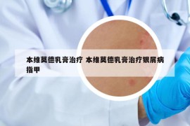 本维莫德乳膏治疗 本维莫德乳膏治疗银屑病指甲