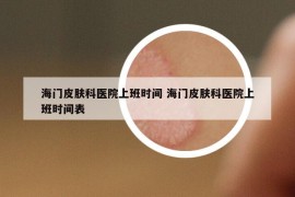 海门皮肤科医院上班时间 海门皮肤科医院上班时间表