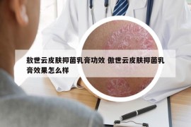 敖世云皮肤抑菌乳膏功效 傲世云皮肤抑菌乳膏效果怎么样