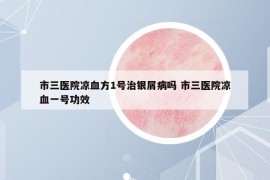 市三医院凉血方1号治银屑病吗 市三医院凉血一号功效