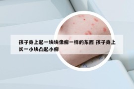 孩子身上起一块块像癣一样的东西 孩子身上长一小块凸起小癣