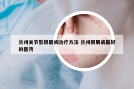 兰州关节型银屑病治疗方法 兰州银屑病最好的医院